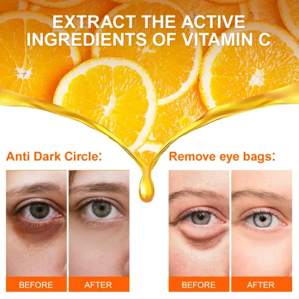 Anti Dark Circle Eye Cream Eye Bags VC Whitening 2